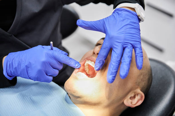 Best Emergency Root Canal Treatment in Croswell, MI